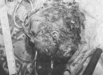 hebergeur image