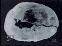 hebergeur image