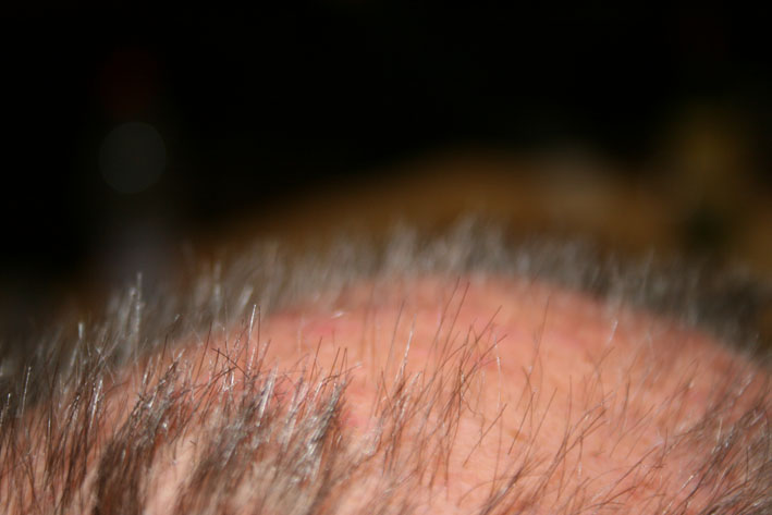 WCT&Acirc;&sup2; (279)